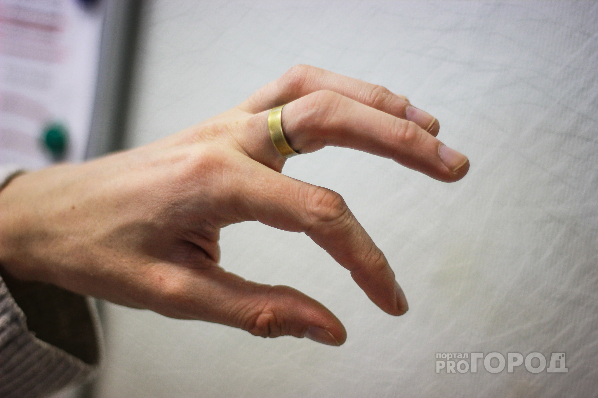 Несчастный случай на работе: жителю Марий Эл отрезало пальцы